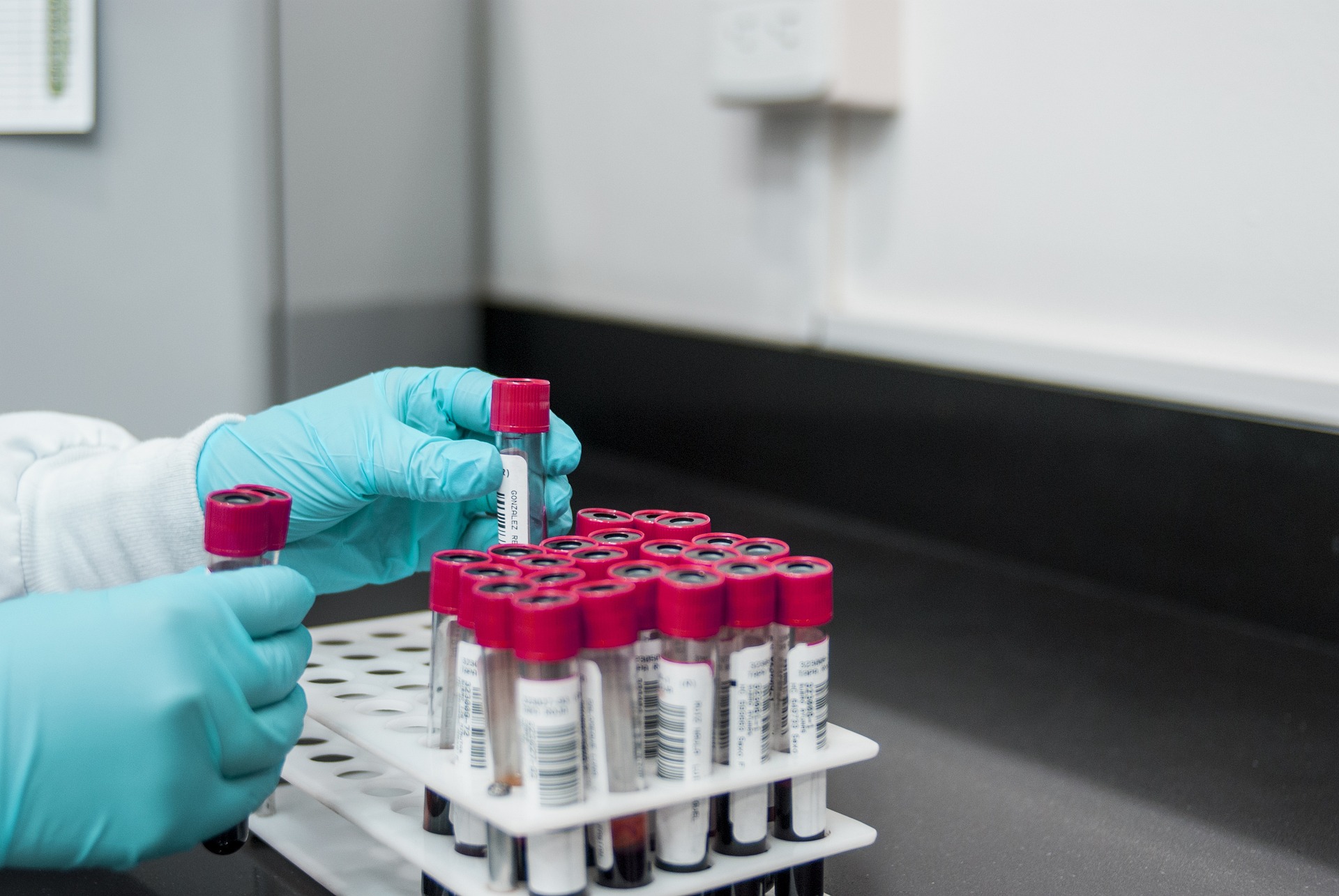 Laboratory Blood Test