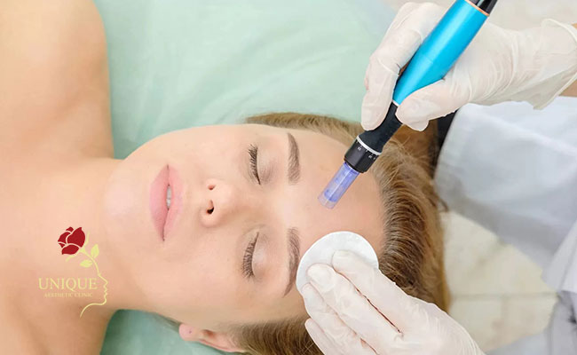 What is meant by eyebrow and hair microneedling?