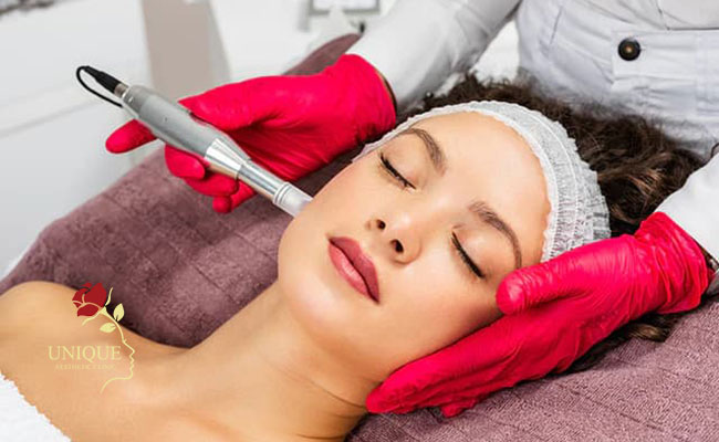 How to do microneedling in Bearsden